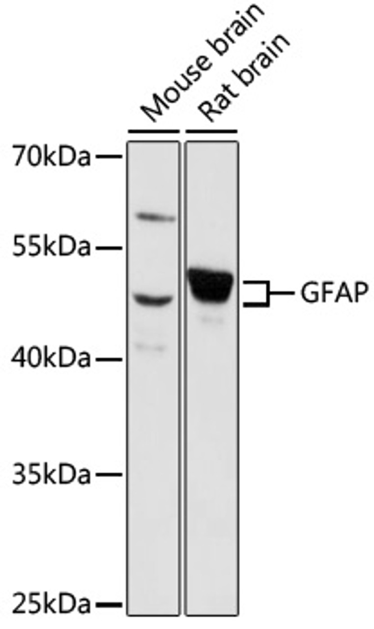Western blot analysis of extracts of various cell lines, using GFAP antibody (15-662) at 1:1000 dilution.<br/>Secondary antibody: HRP Goat Anti-Rabbit IgG (H+L) at 1:10000 dilution.<br/>Lysates/proteins: 25ug per lane.<br/>Blocking buffer: 3% nonfat dry milk in TBST.<br/>Detection: ECL Basic Kit.<br/>Exposure time: 90s.