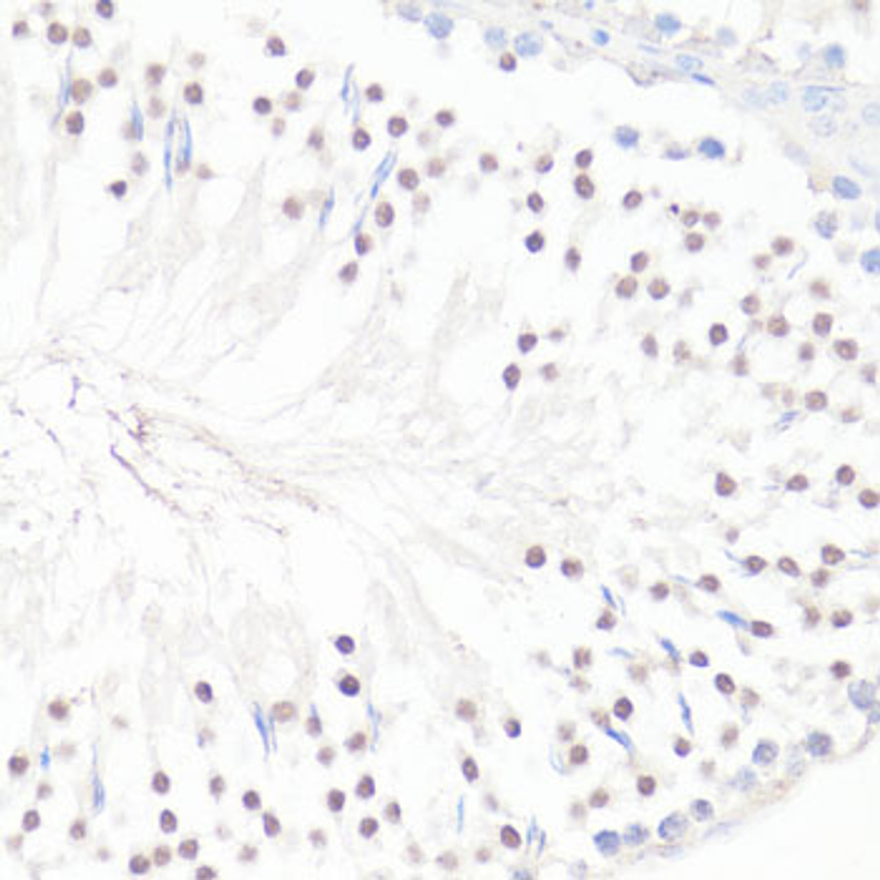 Immunohistochemistry of paraffin-embedded rat testis using GLI1 antibody (15-663) at dilution of 1:100 (40x lens) .