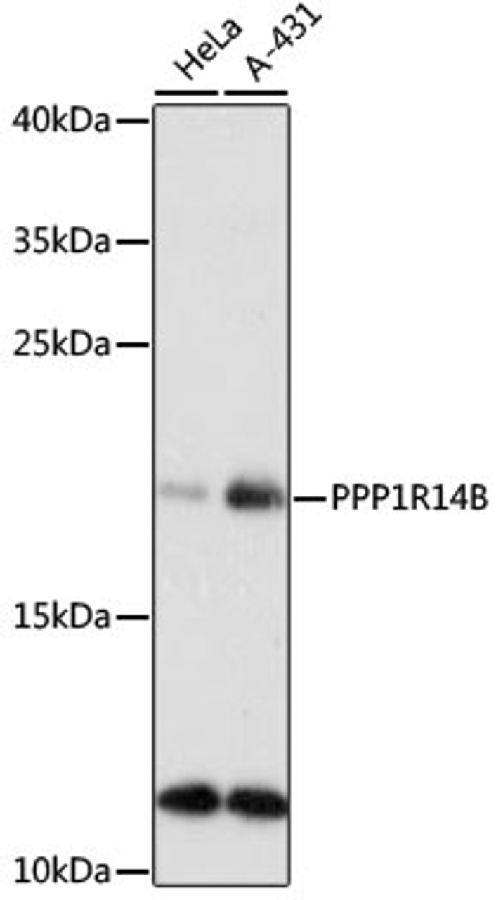 Western blot analysis of extracts of various cell lines, using PPP1R14B antibody (15-664) at 1:1000 dilution.<br/>Secondary antibody: HRP Goat Anti-Rabbit IgG (H+L) at 1:10000 dilution.<br/>Lysates/proteins: 25ug per lane.<br/>Blocking buffer: 3% nonfat dry milk in TBST.<br/>Detection: ECL Basic Kit.<br/>Exposure time: 90s.