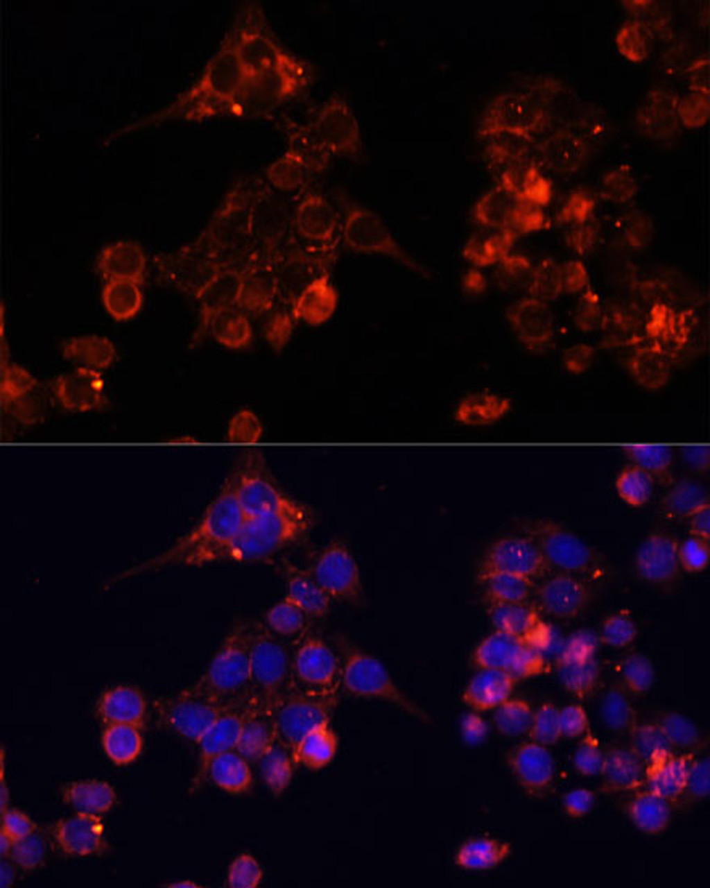 Immunofluorescence analysis of HeLa cells using B4GALT4 antibody (15-668) at dilution of 1:100. Blue: DAPI for nuclear staining.