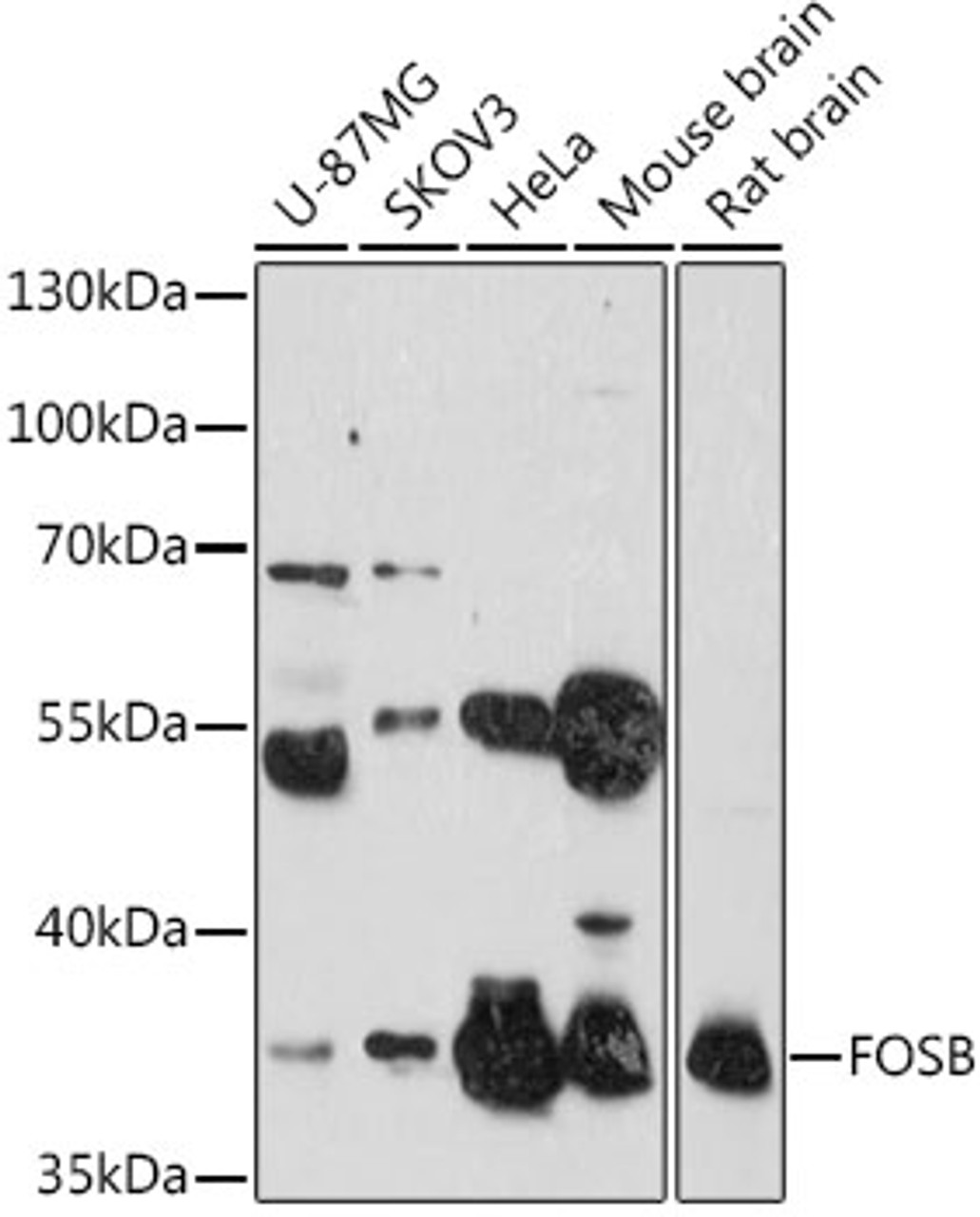 Western blot analysis of extracts of various cell lines, using FOSB antibody (15-671) at 1:1000 dilution.<br/>Secondary antibody: HRP Goat Anti-Rabbit IgG (H+L) at 1:10000 dilution.<br/>Lysates/proteins: 25ug per lane.<br/>Blocking buffer: 3% nonfat dry milk in TBST.<br/>Detection: ECL Basic Kit.<br/>Exposure time: 5s.