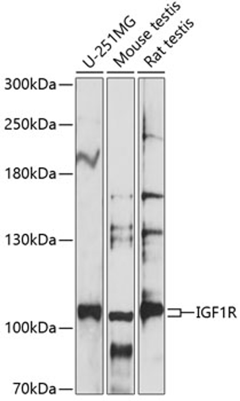 Western blot analysis of extracts of various cell lines, using IGF1R antibody (15-672) at 1:1000 dilution.<br/>Secondary antibody: HRP Goat Anti-Rabbit IgG (H+L) at 1:10000 dilution.<br/>Lysates/proteins: 25ug per lane.<br/>Blocking buffer: 3% nonfat dry milk in TBST.<br/>Detection: ECL Basic Kit.<br/>Exposure time: 15s.