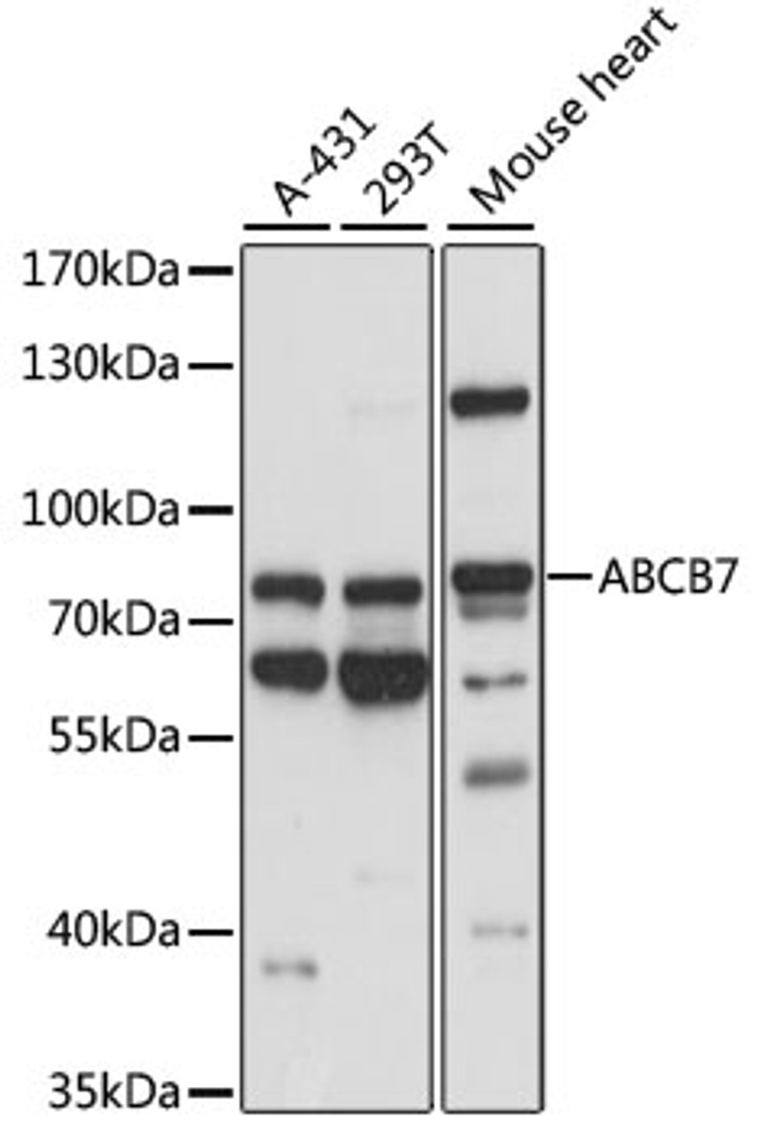 Western blot analysis of extracts of various cell lines, using ABCB7 antibody (15-673) at 1:1000 dilution.<br/>Secondary antibody: HRP Goat Anti-Rabbit IgG (H+L) at 1:10000 dilution.<br/>Lysates/proteins: 25ug per lane.<br/>Blocking buffer: 3% nonfat dry milk in TBST.<br/>Detection: ECL Basic Kit.<br/>Exposure time: 10s.