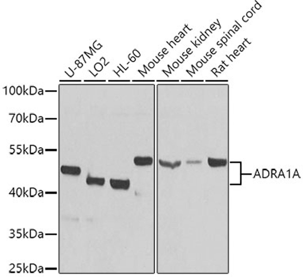 Western blot analysis of extracts of various cell lines, using ADRA1A antibody (15-679) at 1:1000 dilution.<br/>Secondary antibody: HRP Goat Anti-Rabbit IgG (H+L) at 1:10000 dilution.<br/>Lysates/proteins: 25ug per lane.<br/>Blocking buffer: 3% nonfat dry milk in TBST.<br/>Detection: ECL Basic Kit.<br/>Exposure time: 90s.