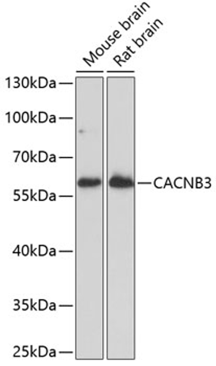 Western blot analysis of extracts of various cell lines, using CACNB3 antibody (15-680) at 1:1000 dilution.<br/>Secondary antibody: HRP Goat Anti-Rabbit IgG (H+L) at 1:10000 dilution.<br/>Lysates/proteins: 25ug per lane.<br/>Blocking buffer: 3% nonfat dry milk in TBST.<br/>Detection: ECL Enhanced Kit.<br/>Exposure time: 90s.