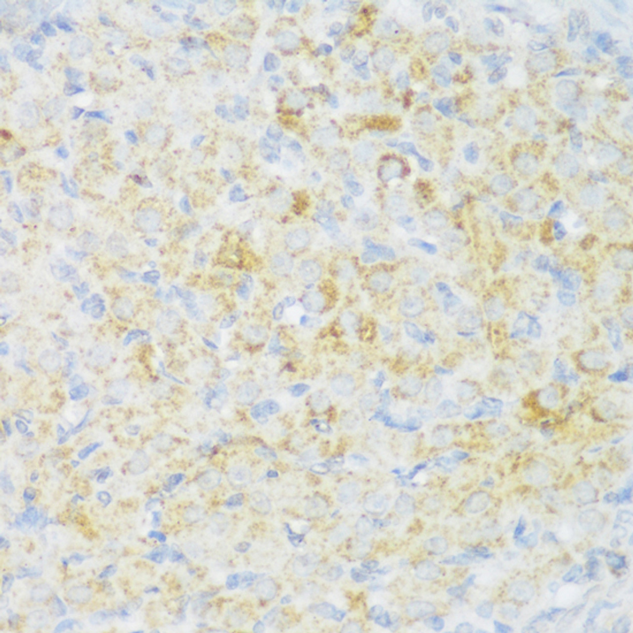 Immunohistochemistry of paraffin-embedded rat ovary using CACNB3 antibody (15-680) at dilution of 1:150 (40x lens) .