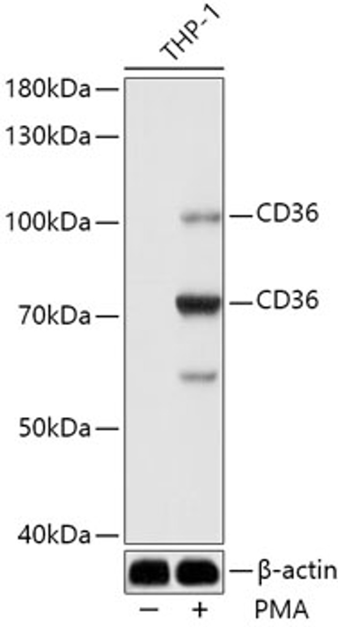 Western blot analysis of extracts of THP-1 cells, using CD36 antibody (15-682) at 1:1000 dilution. THP-1 cells were treated by PMA (80 nM) at 37℃ for overnight.<br/>Secondary antibody: HRP Goat Anti-Rabbit IgG (H+L) at 1:10000 dilution.<br/>Lysates/proteins: 25ug per lane.<br/>Blocking buffer: 3% nonfat dry milk in TBST.<br/>Detection: ECL Basic Kit.<br/>Exposure time: 15s.