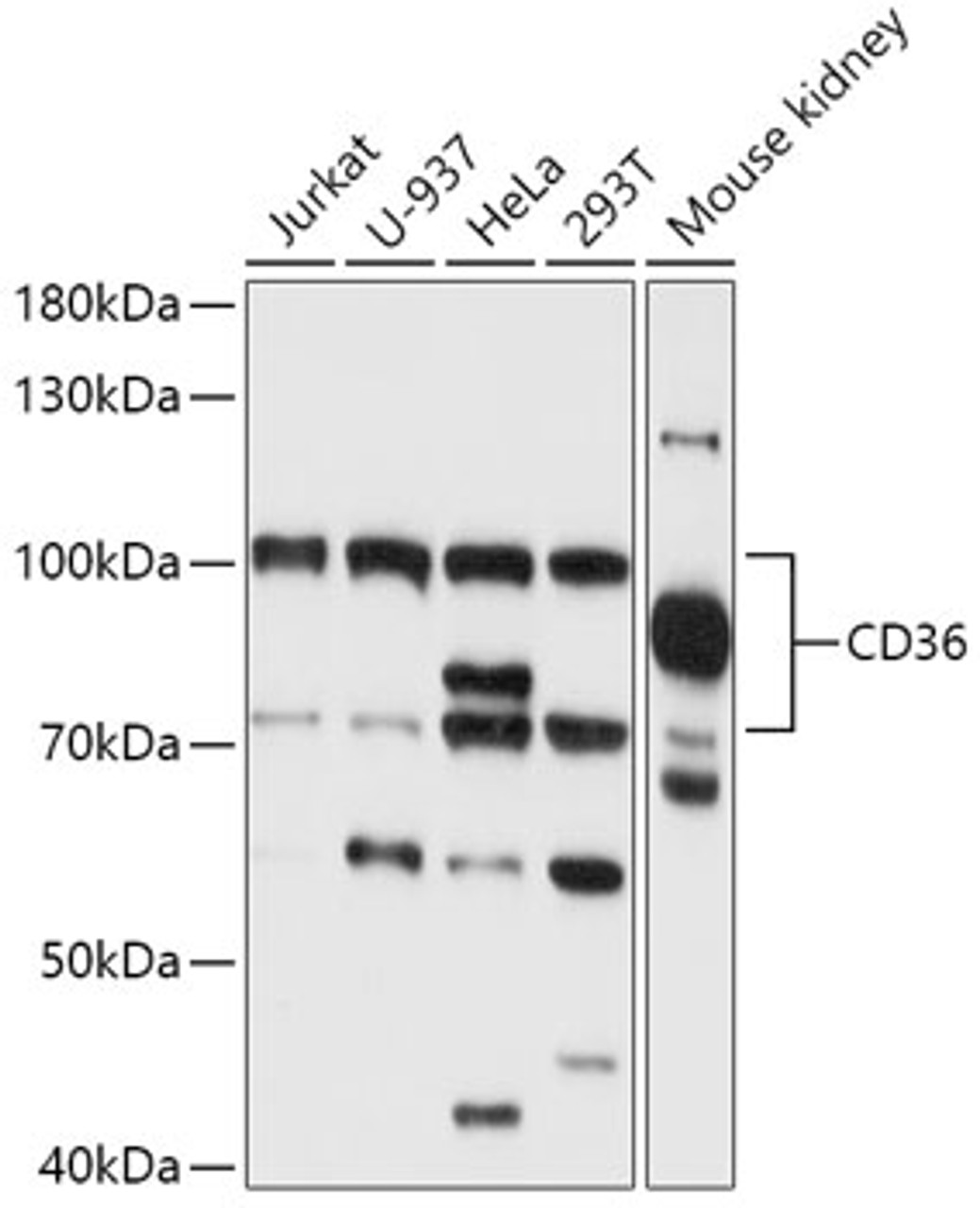 Western blot analysis of extracts of various cell lines, using CD36 antibody (15-682) at 1:1000 dilution.<br/>Secondary antibody: HRP Goat Anti-Rabbit IgG (H+L) at 1:10000 dilution.<br/>Lysates/proteins: 25ug per lane.<br/>Blocking buffer: 3% nonfat dry milk in TBST.<br/>Detection: ECL Basic Kit.<br/>Exposure time: 15s.