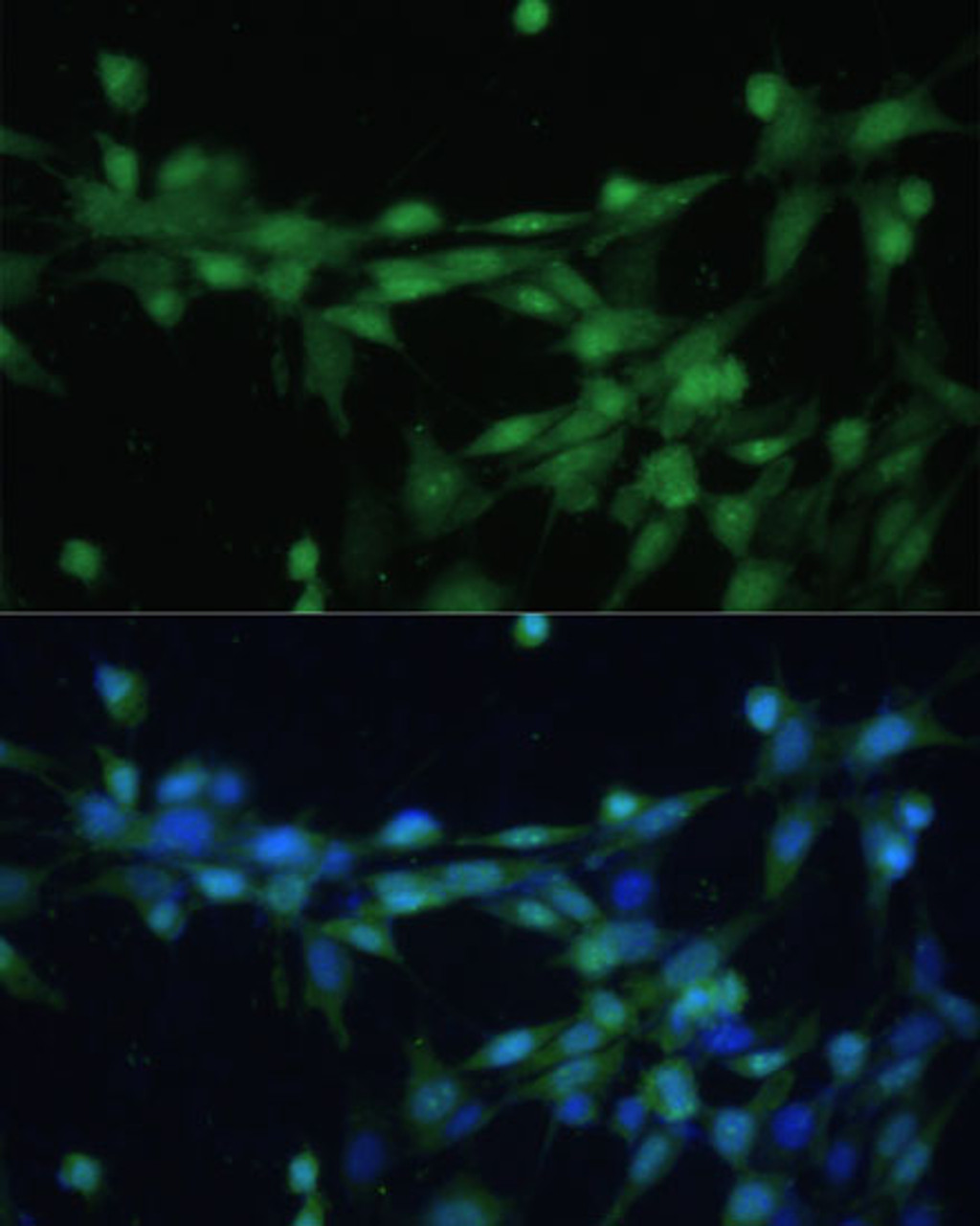 Immunofluorescence analysis of NIH-3T3 cells using CSNK2B Polyclonal Antibody (15-684) at dilution of 1:100 (40x lens) . Blue: DAPI for nuclear staining.