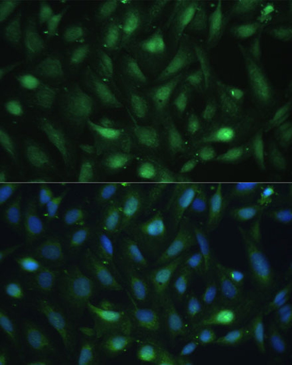 Immunofluorescence analysis of U-2 OS cells using CSNK2B Polyclonal Antibody (15-684) at dilution of 1:100 (40x lens) . Blue: DAPI for nuclear staining.