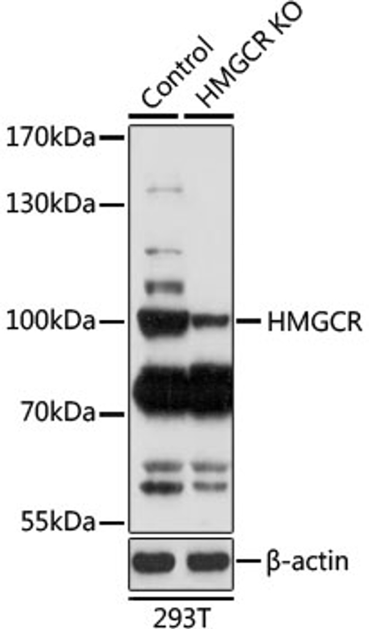 Western blot analysis of extracts from normal (control) and HMGCR knockout (KO) 293T cells, using HMGCR antibody (15-698) at 1:1000 dilution.<br/>Secondary antibody: HRP Goat Anti-Rabbit IgG (H+L) at 1:10000 dilution.<br/>Lysates/proteins: 25ug per lane.<br/>Blocking buffer: 3% nonfat dry milk in TBST.<br/>Detection: ECL Basic Kit.<br/>Exposure time: 3min.