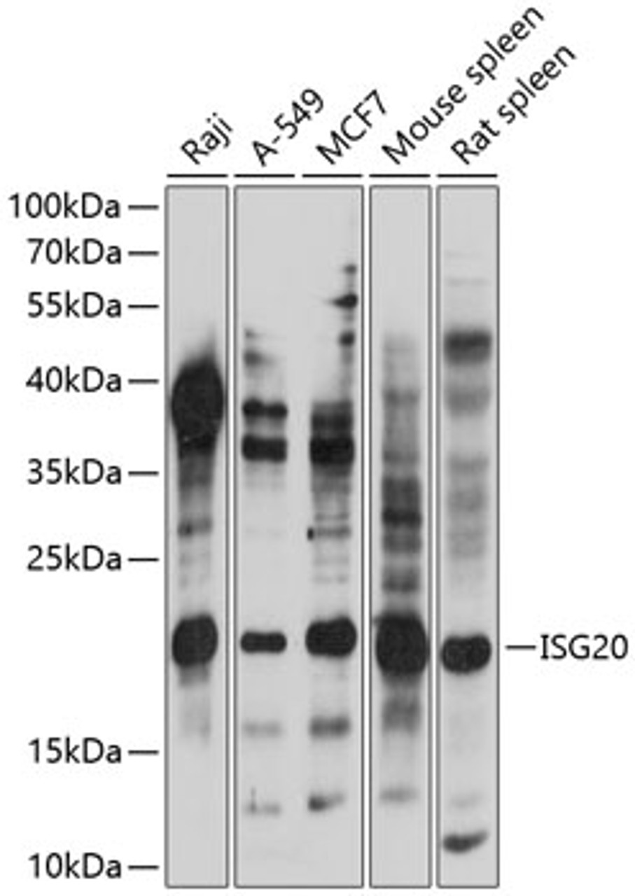 Western blot analysis of extracts of various cell lines, using ISG20 antibody (15-700) at 1:1000 dilution.<br/>Secondary antibody: HRP Goat Anti-Rabbit IgG (H+L) at 1:10000 dilution.<br/>Lysates/proteins: 25ug per lane.<br/>Blocking buffer: 3% nonfat dry milk in TBST.<br/>Detection: ECL Basic Kit.<br/>Exposure time: 10s.