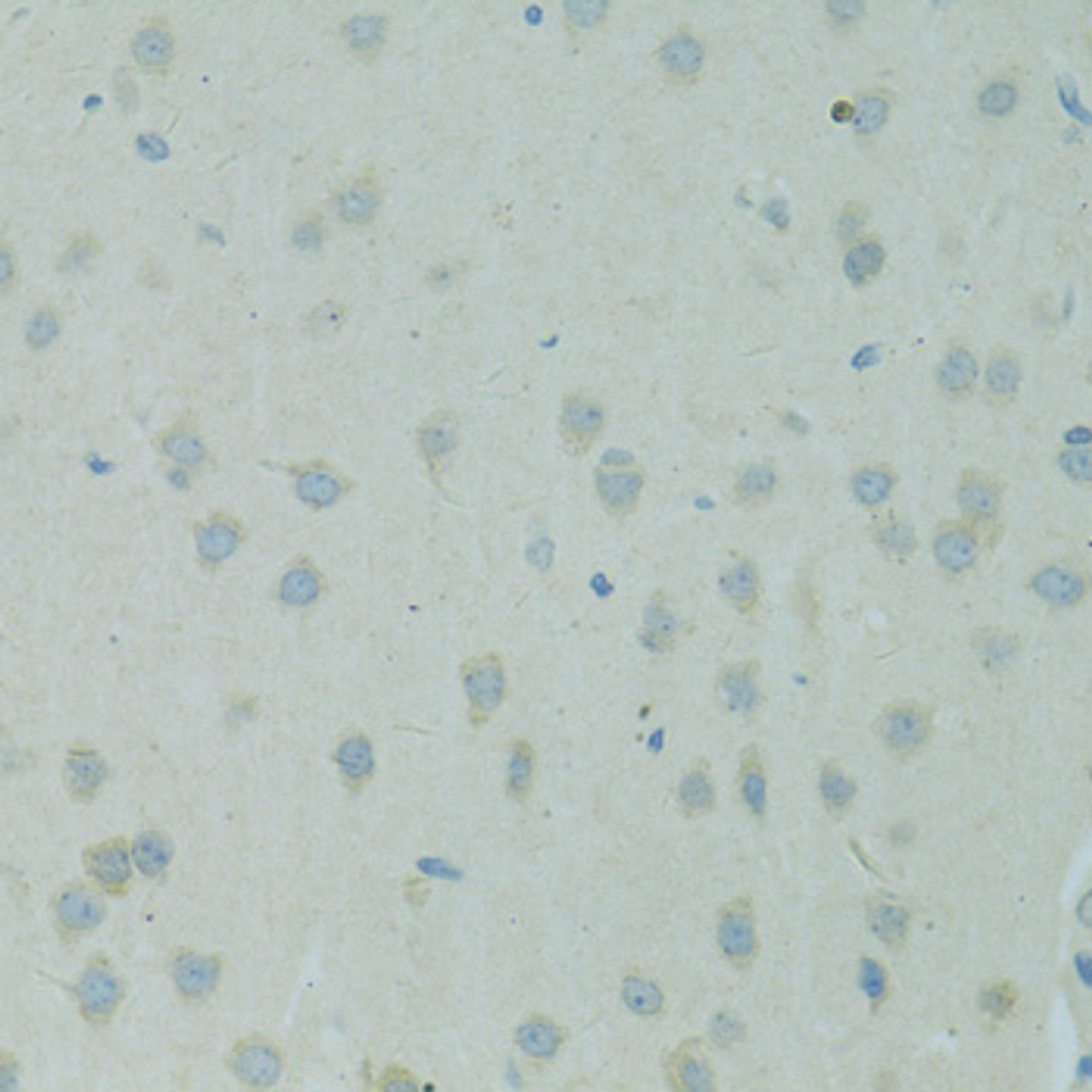 Immunohistochemistry of paraffin-embedded rat brain using SMAD6 antibody (15-704) at dilution of 1:100 (40x lens) .