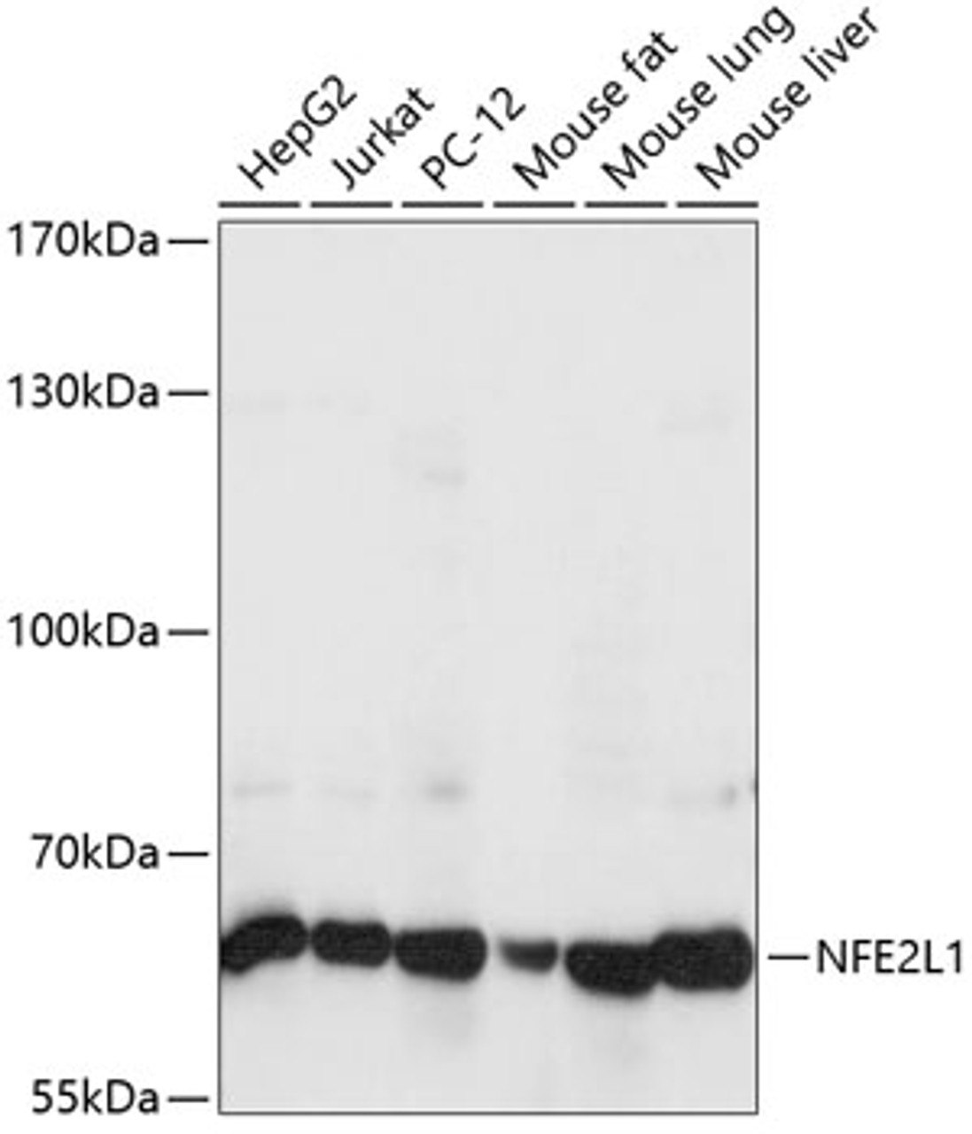 Western blot analysis of extracts of various cell lines, using NFE2L1 antibody (15-708) at 1:1000 dilution.<br/>Secondary antibody: HRP Goat Anti-Rabbit IgG (H+L) at 1:10000 dilution.<br/>Lysates/proteins: 25ug per lane.<br/>Blocking buffer: 3% nonfat dry milk in TBST.<br/>Detection: ECL Basic Kit.<br/>Exposure time: 1s.