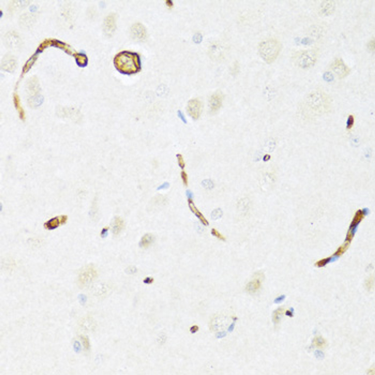 Immunohistochemistry of paraffin-embedded rat brain using P Glycoprotein antibody (15-715) at dilution of 1:100 (40x lens) .