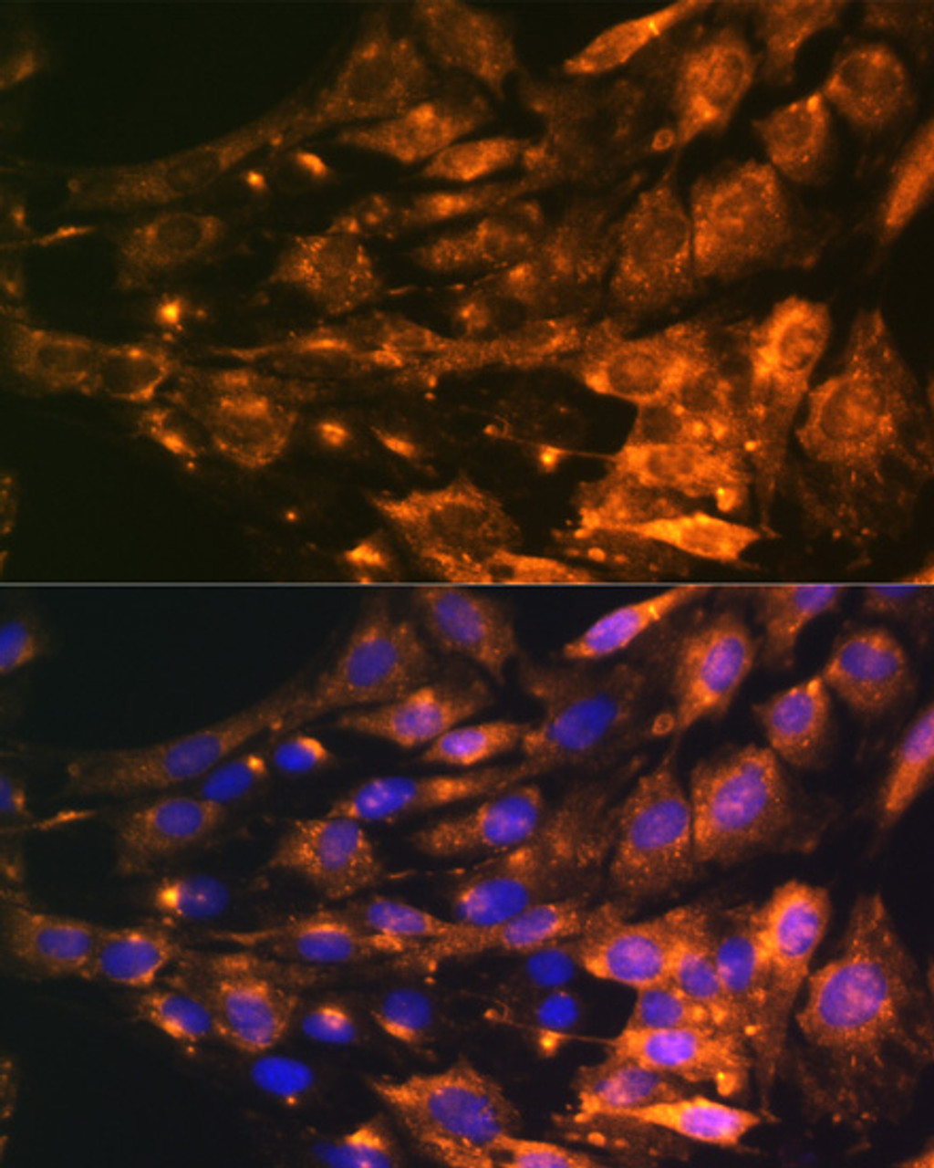Immunofluorescence analysis of C6 cells using PTCH1 antibody (15-720) at dilution of 1:100. Blue: DAPI for nuclear staining.