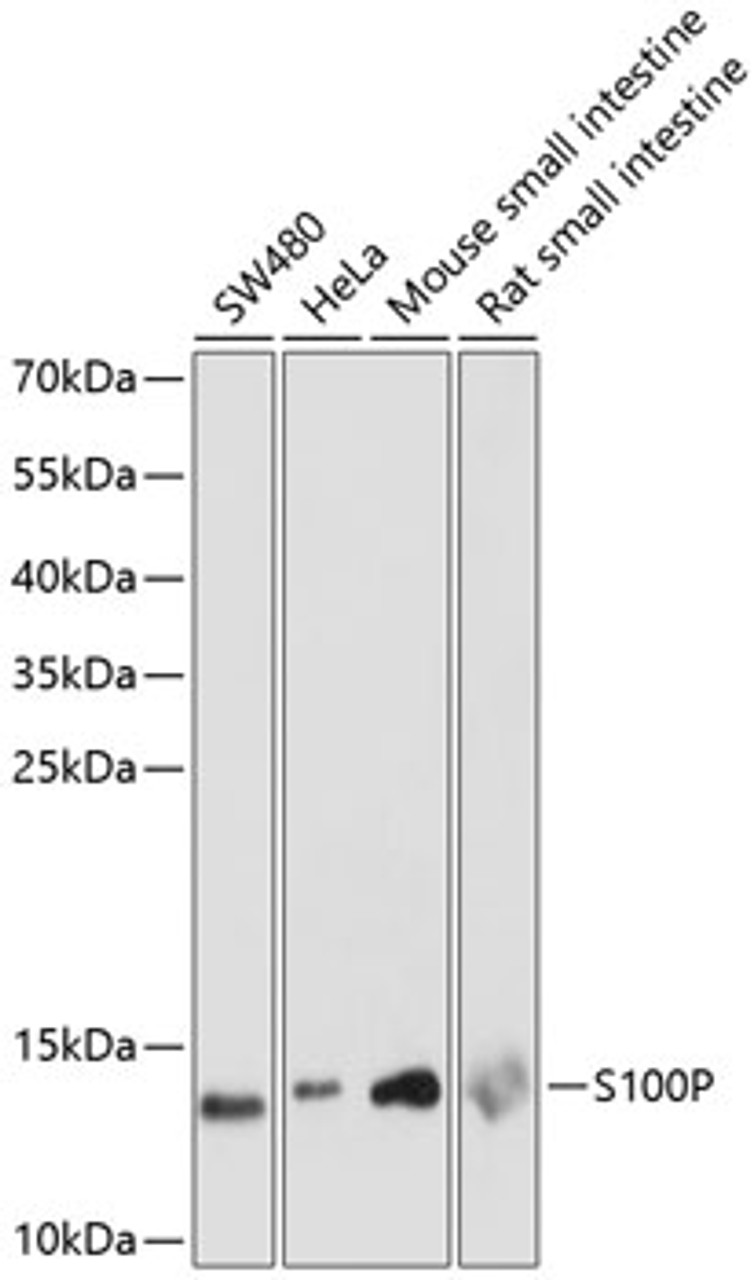 Western blot analysis of extracts of various cell lines, using S100P antibody (15-726) at 1:1000 dilution.<br/>Secondary antibody: HRP Goat Anti-Rabbit IgG (H+L) at 1:10000 dilution.<br/>Lysates/proteins: 25ug per lane.<br/>Blocking buffer: 3% nonfat dry milk in TBST.<br/>Detection: ECL Enhanced Kit.<br/>Exposure time: 90s.