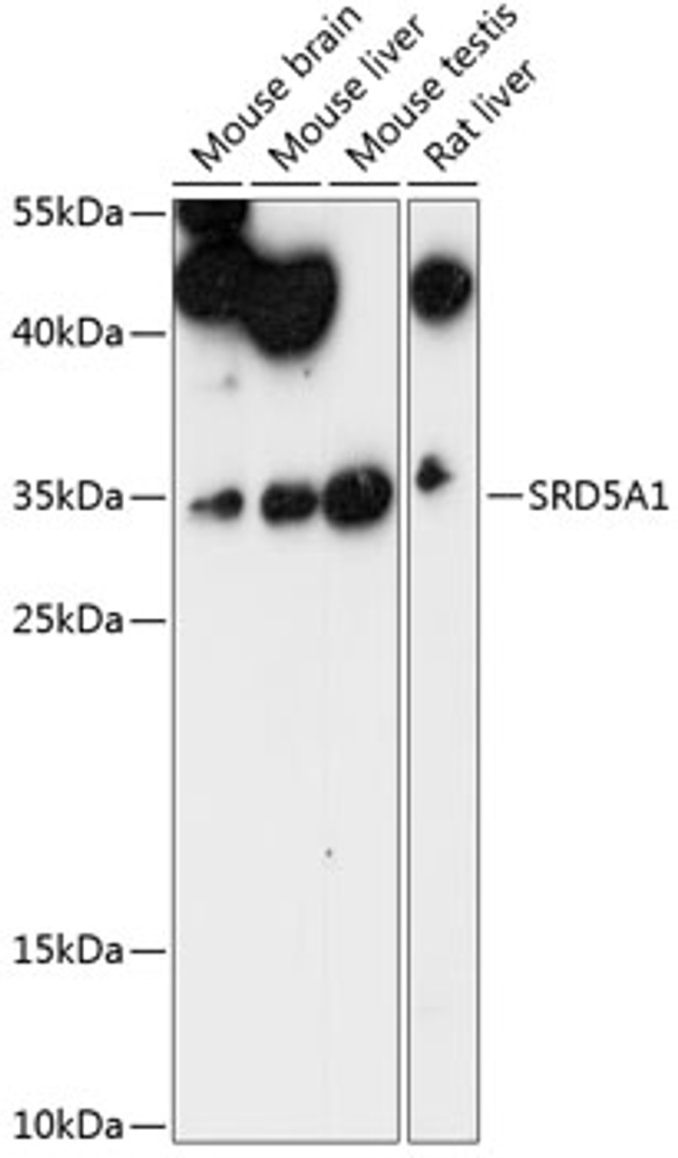 Western blot analysis of extracts of various cell lines, using SRD5A1 antibody (15-730) at 1:1000 dilution.<br/>Secondary antibody: HRP Goat Anti-Rabbit IgG (H+L) at 1:10000 dilution.<br/>Lysates/proteins: 25ug per lane.<br/>Blocking buffer: 3% nonfat dry milk in TBST.<br/>Detection: ECL Enhanced Kit.<br/>Exposure time: 90s.