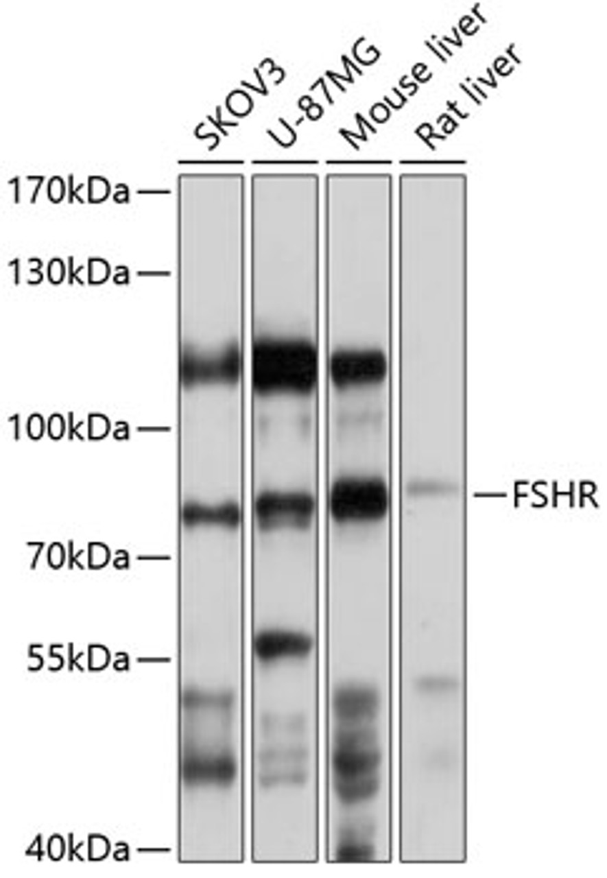 Western blot analysis of extracts of various cell lines, using FSHR antibody (15-735) at 1:1000 dilution.<br/>Secondary antibody: HRP Goat Anti-Rabbit IgG (H+L) at 1:10000 dilution.<br/>Lysates/proteins: 25ug per lane.<br/>Blocking buffer: 3% nonfat dry milk in TBST.<br/>Detection: ECL Basic Kit.<br/>Exposure time: 20s.