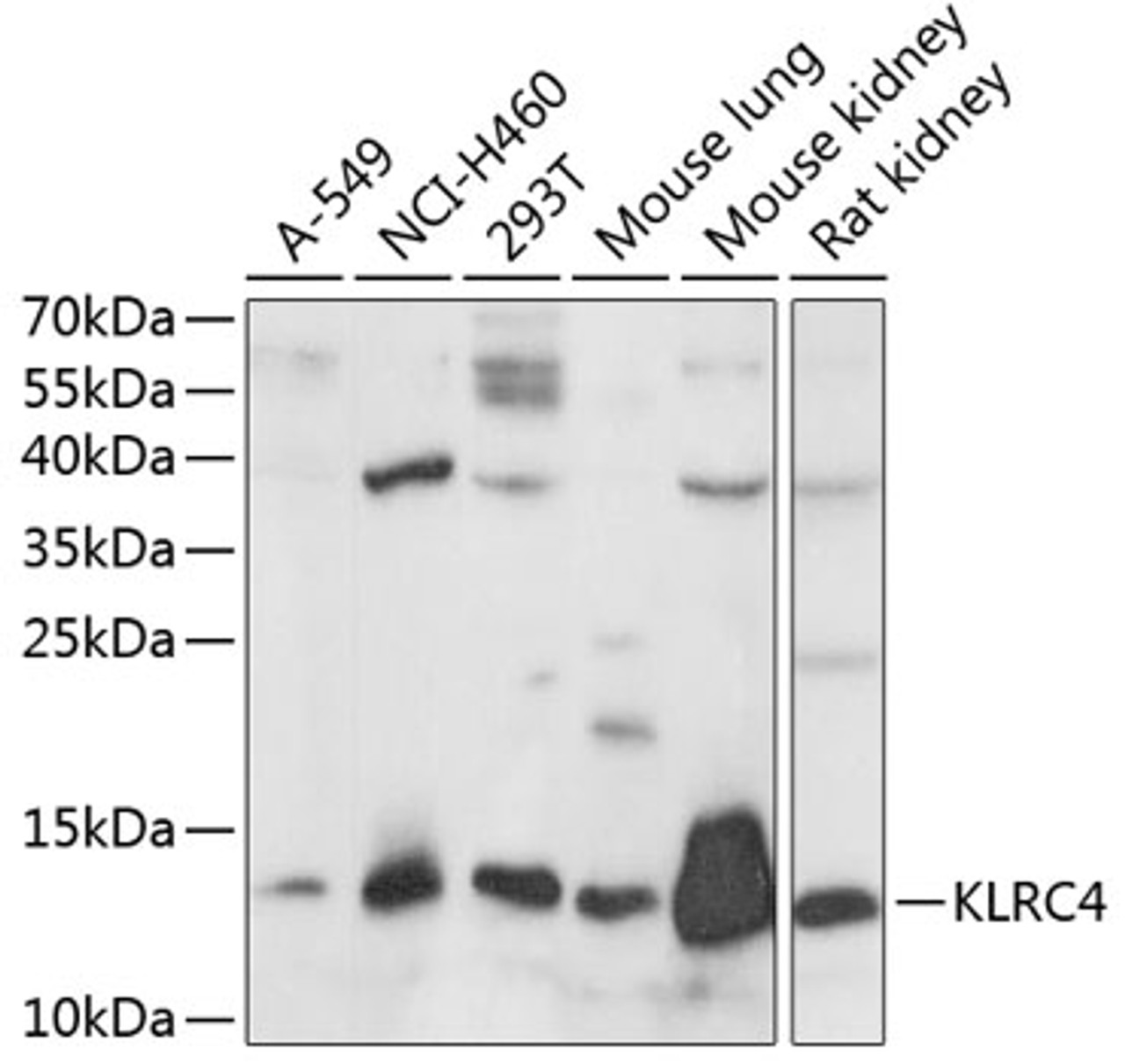 Western blot analysis of extracts of various cell lines, using KLRC4 antibody (15-739) at 1:1000 dilution.<br/>Secondary antibody: HRP Goat Anti-Rabbit IgG (H+L) at 1:10000 dilution.<br/>Lysates/proteins: 25ug per lane.<br/>Blocking buffer: 3% nonfat dry milk in TBST.<br/>Detection: ECL Basic Kit.<br/>Exposure time: 30s.