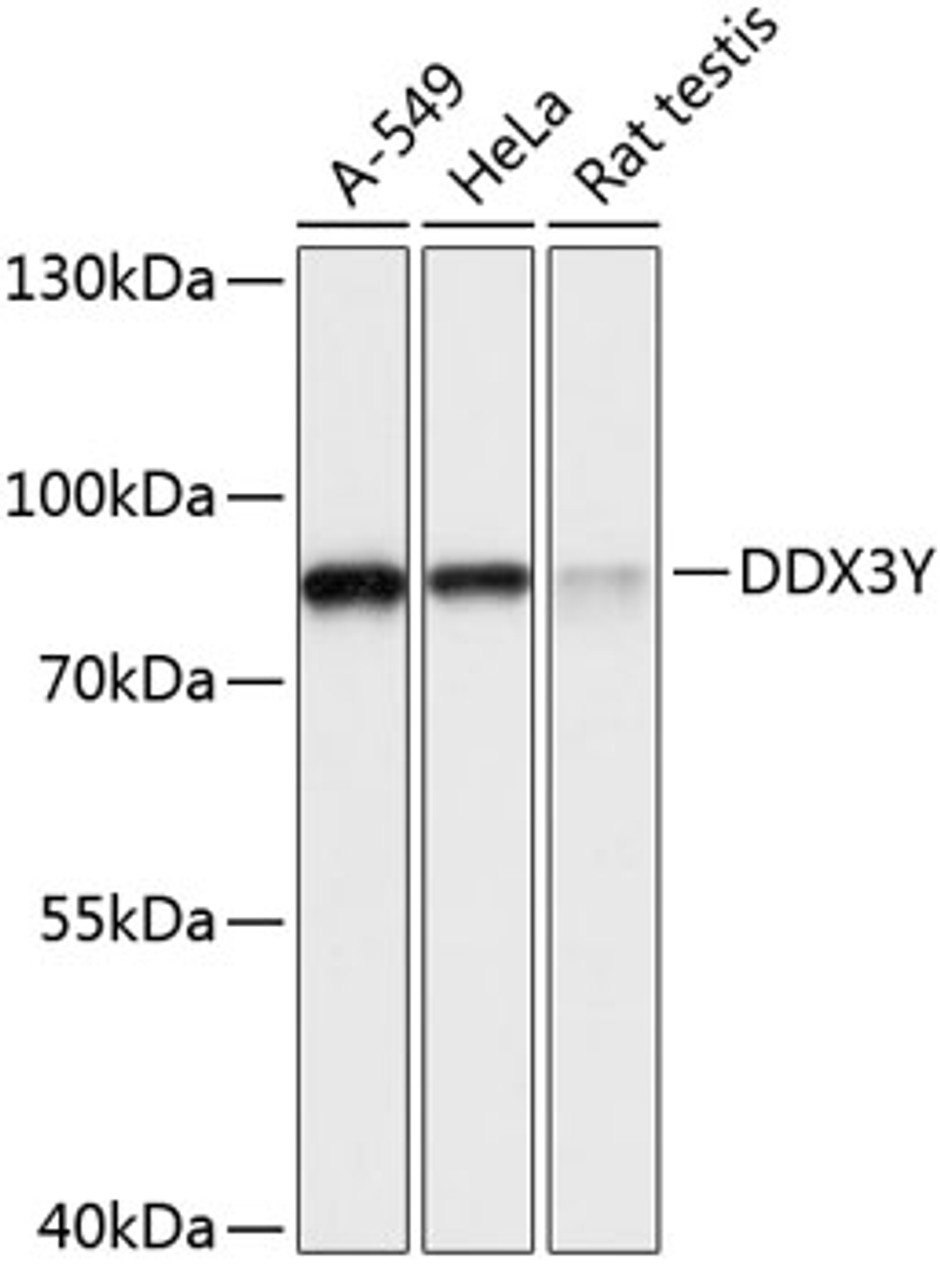 Western blot analysis of extracts of various cell lines, using DDX3Y antibody (15-741) at 1:3000 dilution.<br/>Secondary antibody: HRP Goat Anti-Rabbit IgG (H+L) at 1:10000 dilution.<br/>Lysates/proteins: 25ug per lane.<br/>Blocking buffer: 3% nonfat dry milk in TBST.<br/>Detection: ECL Basic Kit.<br/>Exposure time: 1s.