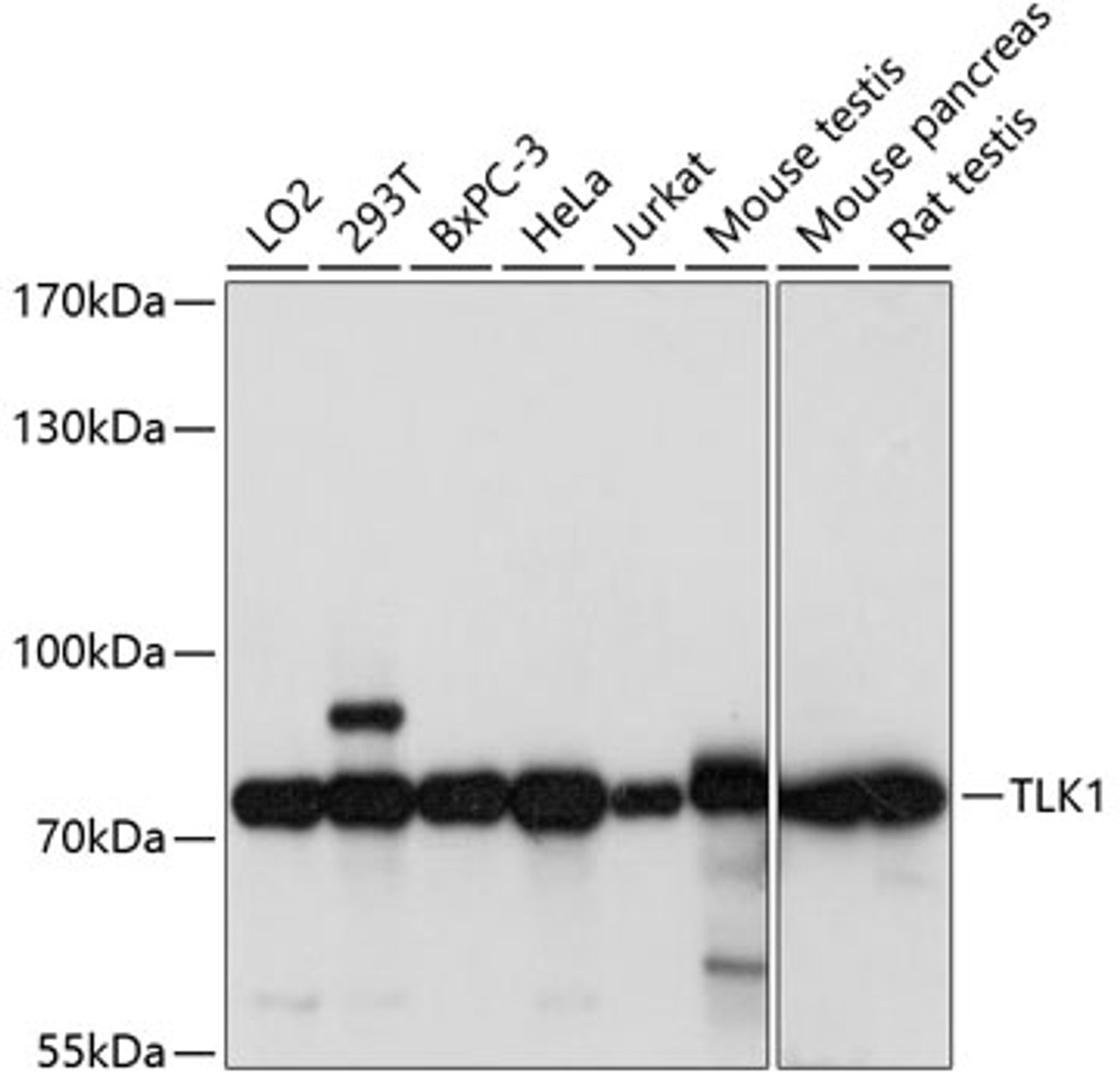 Western blot analysis of extracts of various cell lines, using TLK1 antibody (15-755) at 1:1000 dilution.<br/>Secondary antibody: HRP Goat Anti-Rabbit IgG (H+L) at 1:10000 dilution.<br/>Lysates/proteins: 25ug per lane.<br/>Blocking buffer: 3% nonfat dry milk in TBST.<br/>Detection: ECL Basic Kit.<br/>Exposure time: 1s.