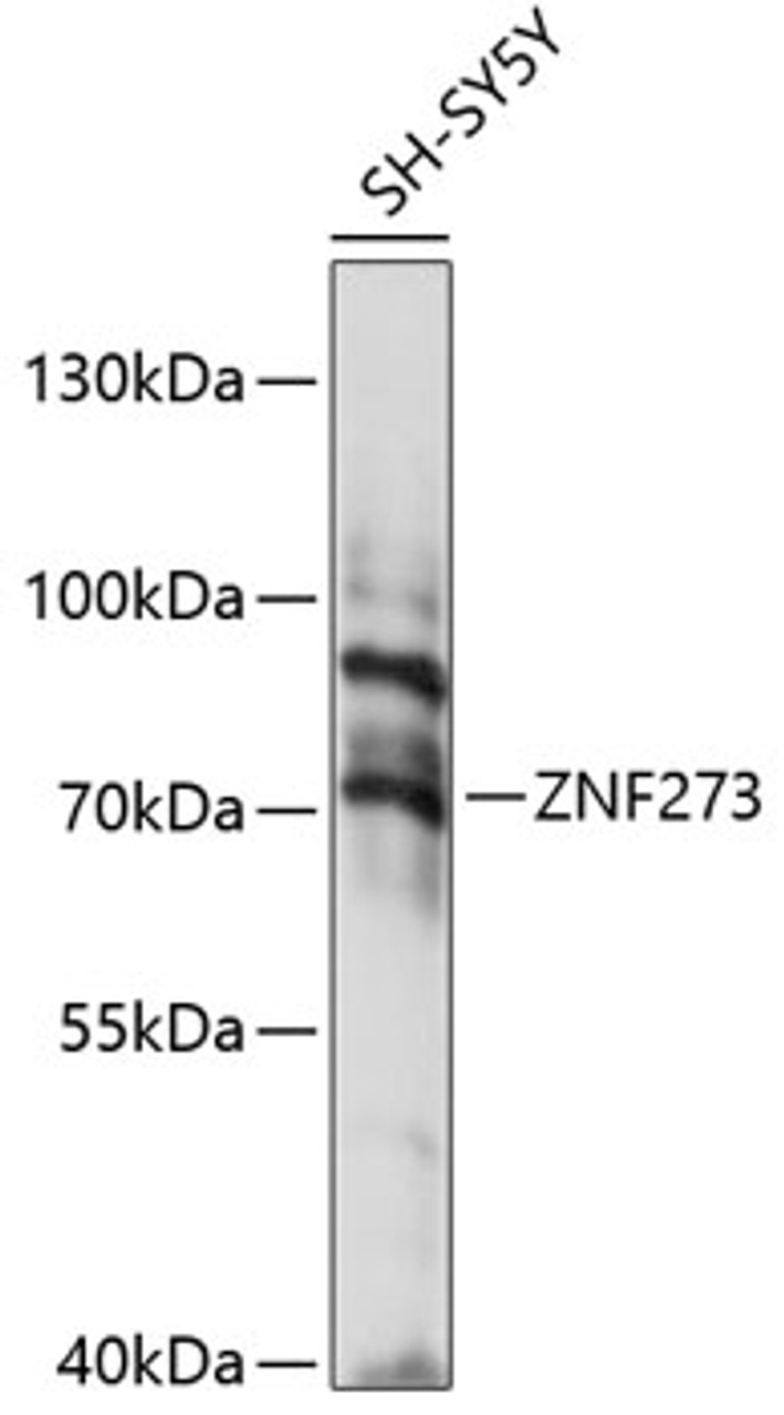 Western blot analysis of extracts of SH-SY5Y cells, using ZNF273 antibody (15-760) at 1:1000 dilution.<br/>Secondary antibody: HRP Goat Anti-Rabbit IgG (H+L) at 1:10000 dilution.<br/>Lysates/proteins: 25ug per lane.<br/>Blocking buffer: 3% nonfat dry milk in TBST.<br/>Detection: ECL Basic Kit.<br/>Exposure time: 15s.