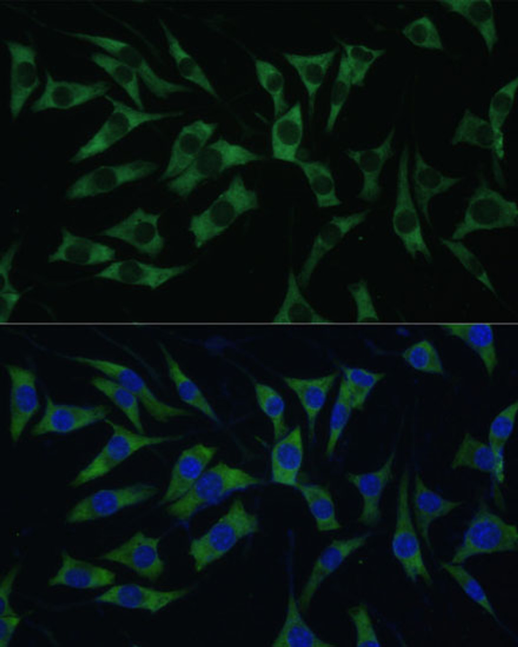 Immunofluorescence analysis of L929 cells using PABPC1 Polyclonal Antibody (15-770) at dilution of 1:100 (40x lens) . Blue: DAPI for nuclear staining.