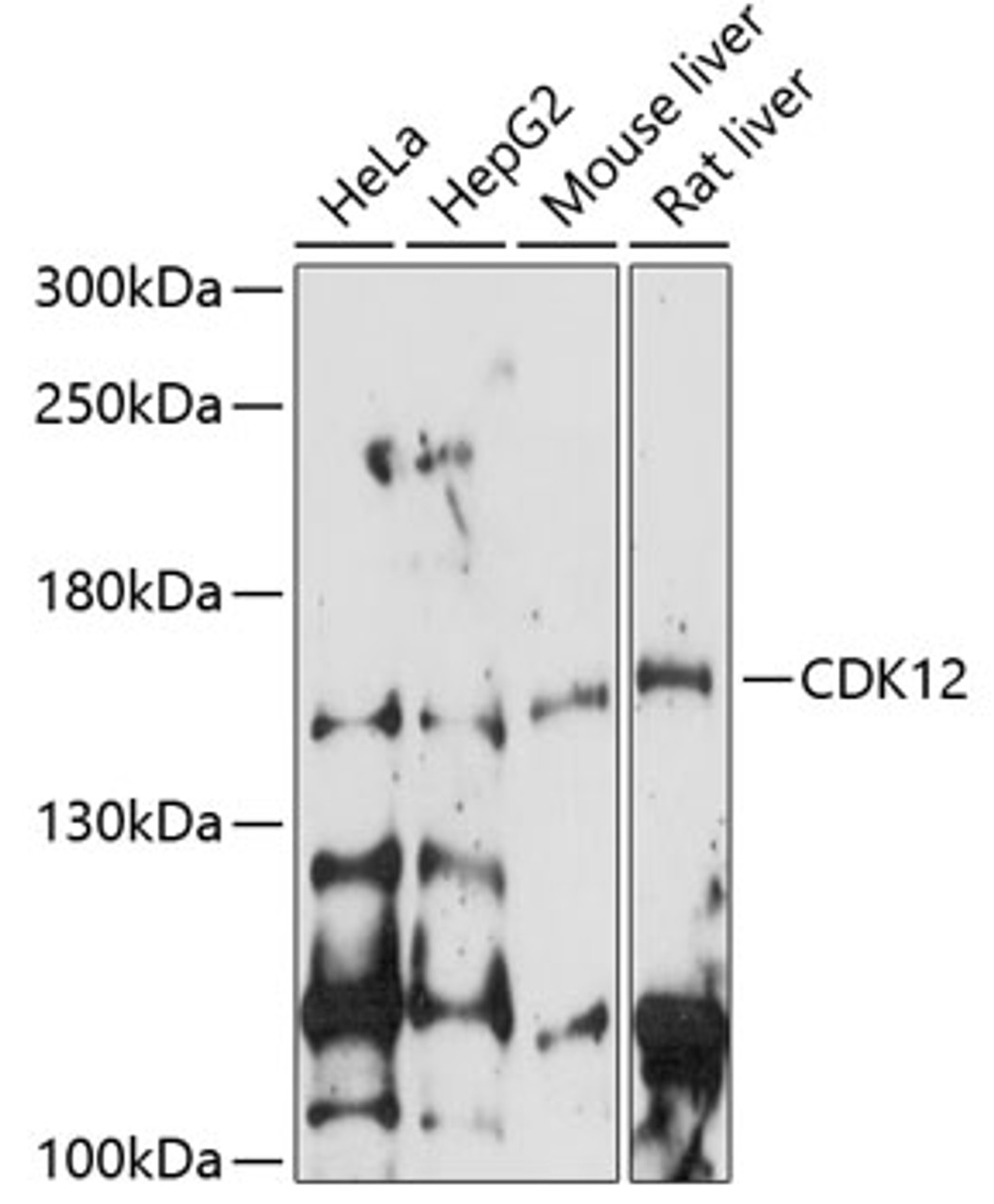 Western blot analysis of extracts of various cell lines, using CDK12 antibody (15-778) at 1:1000 dilution.<br/>Secondary antibody: HRP Goat Anti-Rabbit IgG (H+L) at 1:10000 dilution.<br/>Lysates/proteins: 25ug per lane.<br/>Blocking buffer: 3% nonfat dry milk in TBST.<br/>Detection: ECL Enhanced Kit.<br/>Exposure time: 90s.