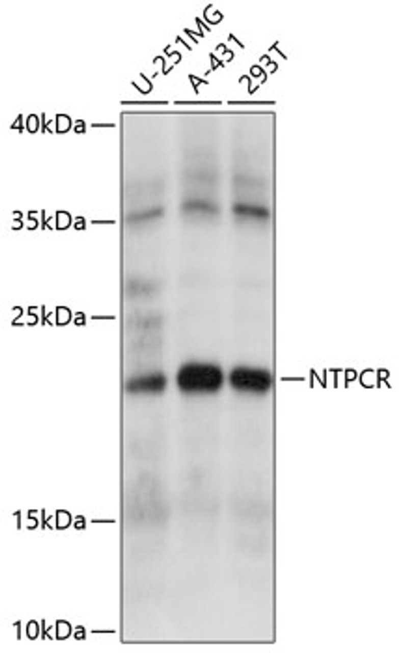Western blot analysis of extracts of various cell lines, using NTPCR antibody (15-799) at 1:1000 dilution.<br/>Secondary antibody: HRP Goat Anti-Rabbit IgG (H+L) at 1:10000 dilution.<br/>Lysates/proteins: 25ug per lane.<br/>Blocking buffer: 3% nonfat dry milk in TBST.<br/>Detection: ECL Basic Kit.<br/>Exposure time: 10s.