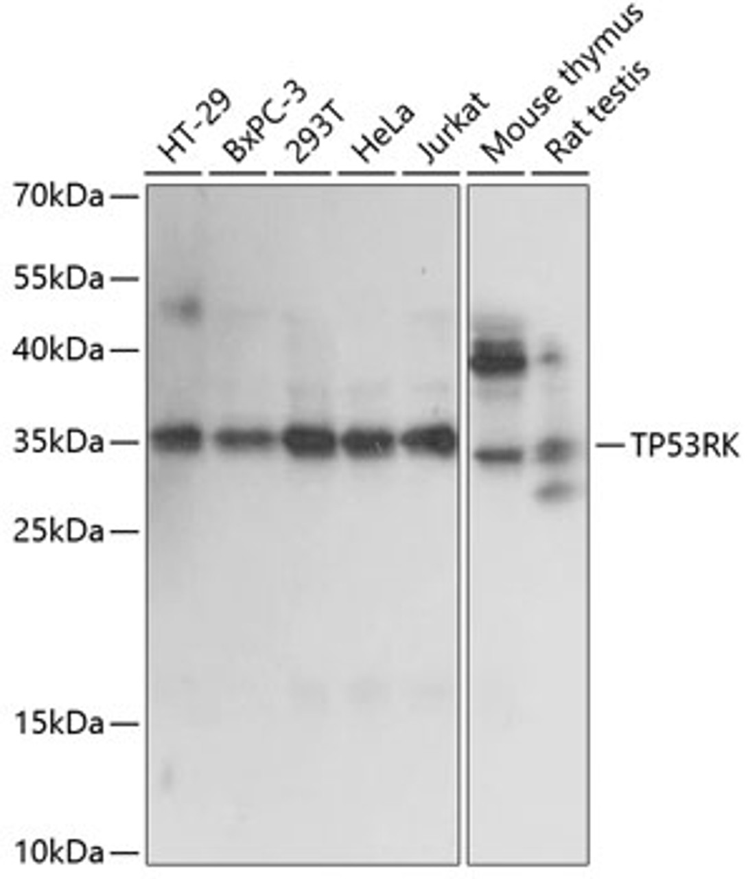 Western blot analysis of extracts of various cell lines, using TP53RK antibody (15-802) at 1:1000 dilution.<br/>Secondary antibody: HRP Goat Anti-Rabbit IgG (H+L) at 1:10000 dilution.<br/>Lysates/proteins: 25ug per lane.<br/>Blocking buffer: 3% nonfat dry milk in TBST.<br/>Detection: ECL Basic Kit.<br/>Exposure time: 5s.