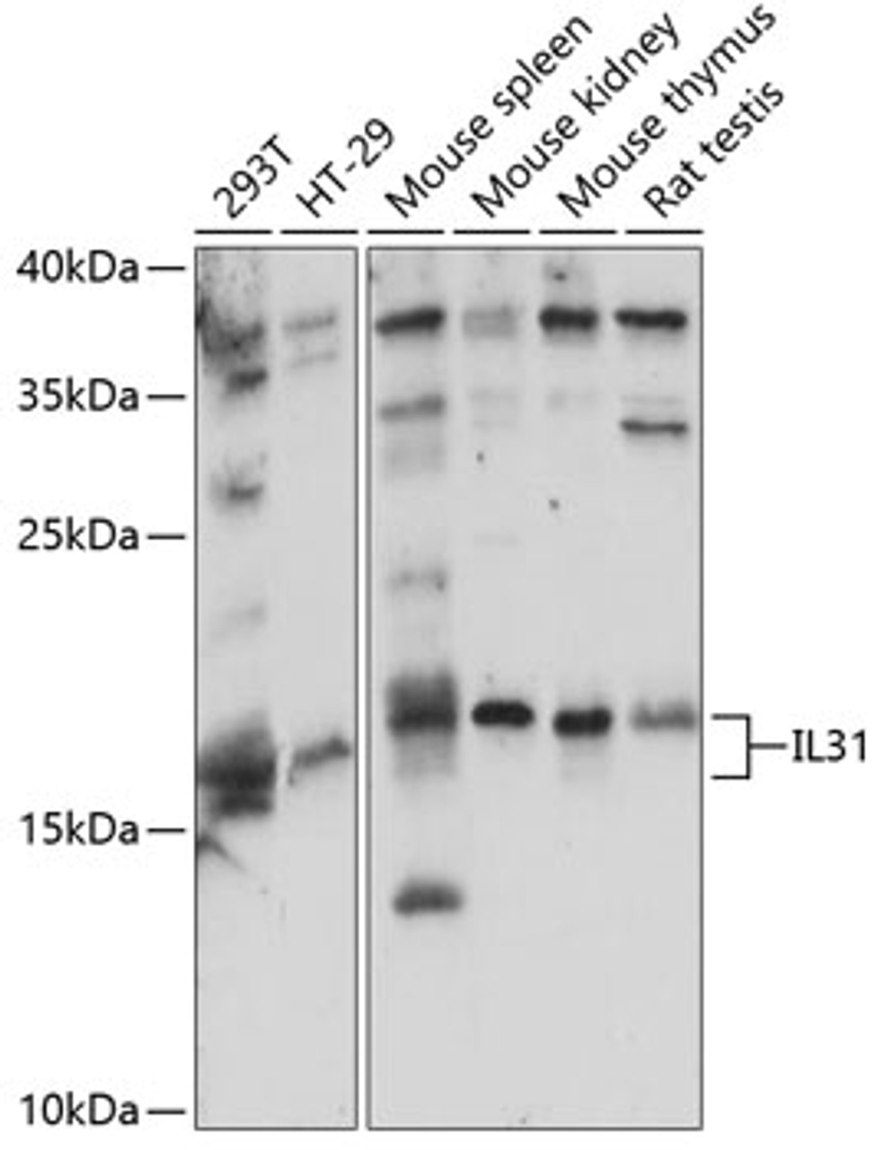 Western blot analysis of extracts of various cell lines, using IL31 antibody (15-817) at 1:1000 dilution.<br/>Secondary antibody: HRP Goat Anti-Rabbit IgG (H+L) at 1:10000 dilution.<br/>Lysates/proteins: 25ug per lane.<br/>Blocking buffer: 3% nonfat dry milk in TBST.<br/>Detection: ECL Basic Kit.<br/>Exposure time: 90s.
