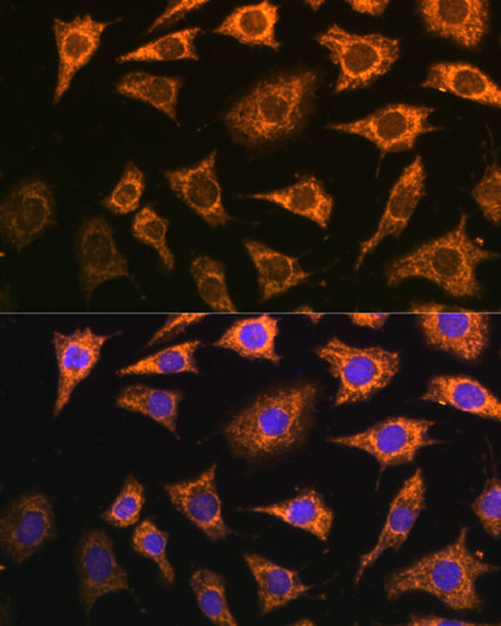 Immunofluorescence analysis of L929 cells using PDHA2 Polyclonal Antibody (15-822) at dilution of 1:100 (40x lens) . Blue: DAPI for nuclear staining.