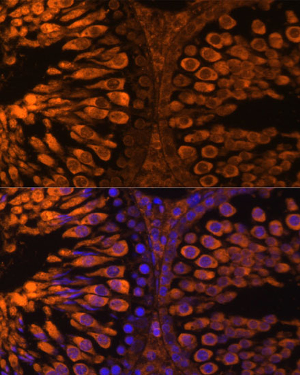 Immunofluorescence analysis of rat testis using LDHC Polyclonal Antibody (15-825) at dilution of 1:100 (40x lens) . Blue: DAPI for nuclear staining.