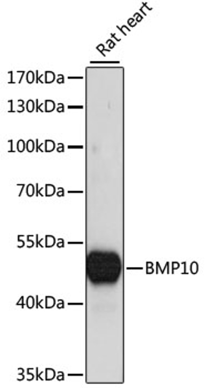 Western blot analysis of extracts of rat heart, using BMP10 antibody (15-829) at 1:1000 dilution.<br/>Secondary antibody: HRP Goat Anti-Rabbit IgG (H+L) at 1:10000 dilution.<br/>Lysates/proteins: 25ug per lane.<br/>Blocking buffer: 3% nonfat dry milk in TBST.<br/>Detection: ECL Basic Kit.<br/>Exposure time: 15s.