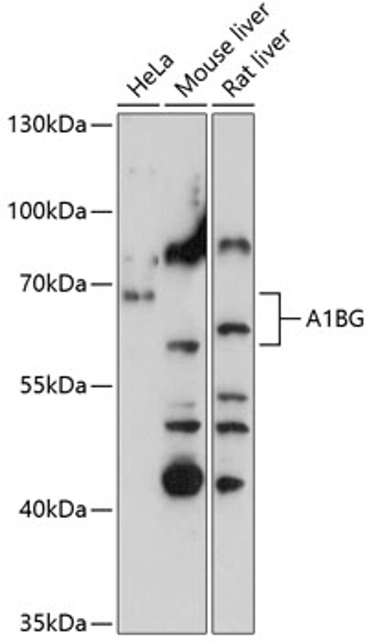 Western blot analysis of extracts of various cell lines, using A1BG antibody (15-832) at 1:3000 dilution.<br/>Secondary antibody: HRP Goat Anti-Rabbit IgG (H+L) at 1:10000 dilution.<br/>Lysates/proteins: 25ug per lane.<br/>Blocking buffer: 3% nonfat dry milk in TBST.<br/>Detection: ECL Basic Kit.<br/>Exposure time: 90s.