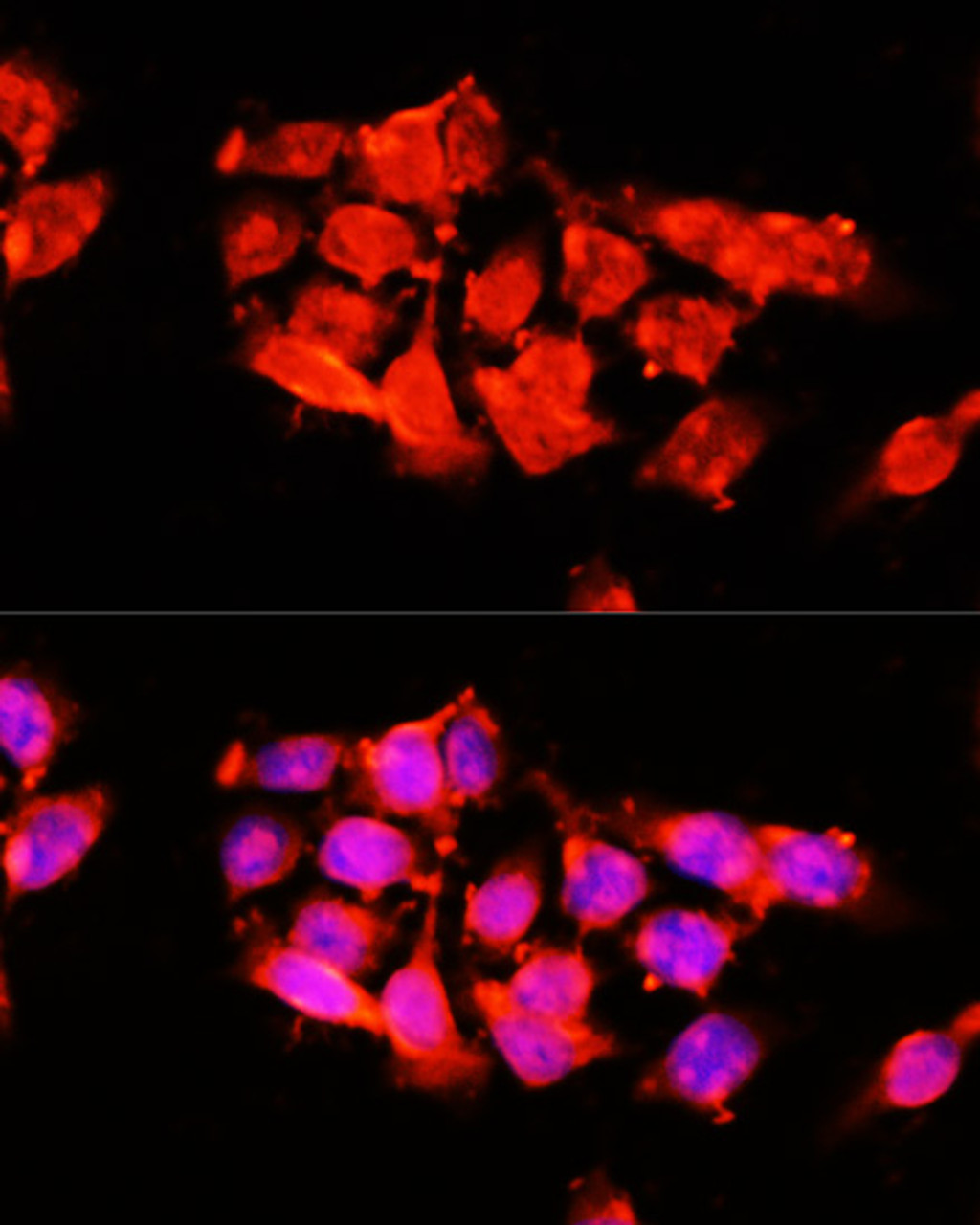 Immunofluorescence analysis of 293T cells using A1BG antibody (15-832) at dilution of 1:100 (40x lens) . Blue: DAPI for nuclear staining.