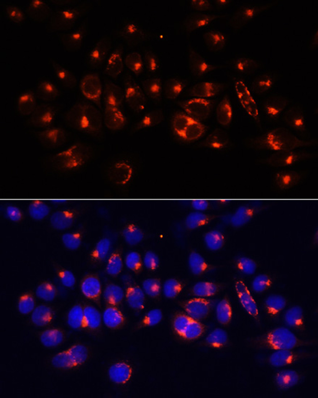 Immunofluorescence analysis of 293T cells using AARS antibody (15-833) at dilution of 1:100 (40x lens) . Blue: DAPI for nuclear staining.
