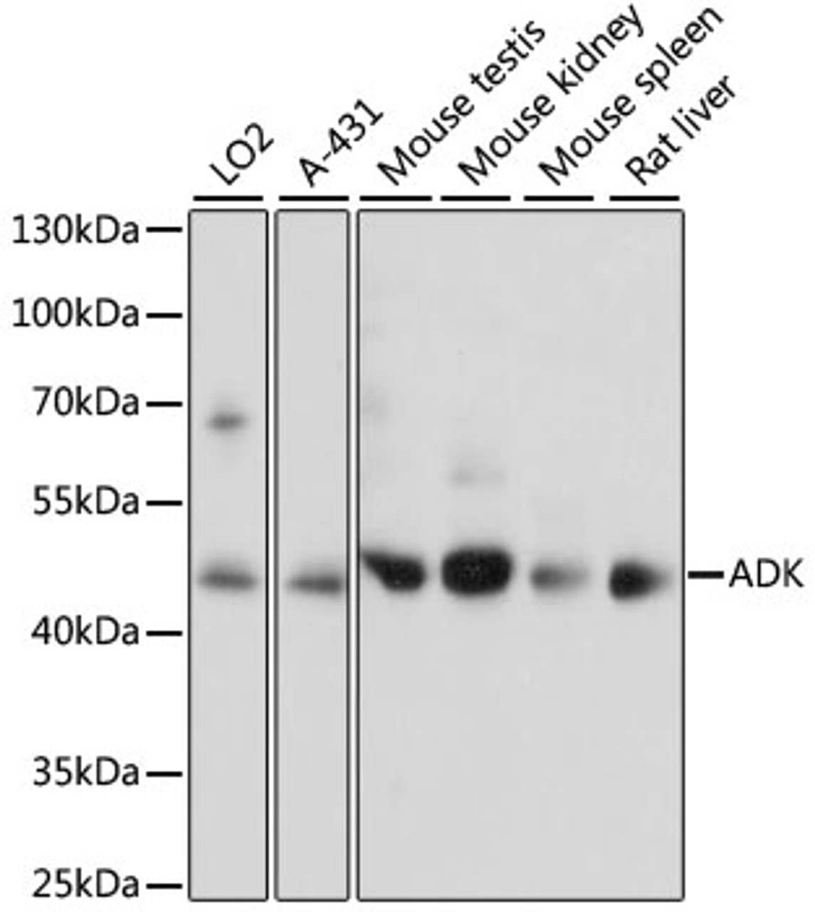 Western blot analysis of extracts of various cell lines, using ADK antibody (15-836) at 1:1000 dilution.<br/>Secondary antibody: HRP Goat Anti-Rabbit IgG (H+L) at 1:10000 dilution.<br/>Lysates/proteins: 25ug per lane.<br/>Blocking buffer: 3% nonfat dry milk in TBST.<br/>Detection: ECL Basic Kit.<br/>Exposure time: 5s.
