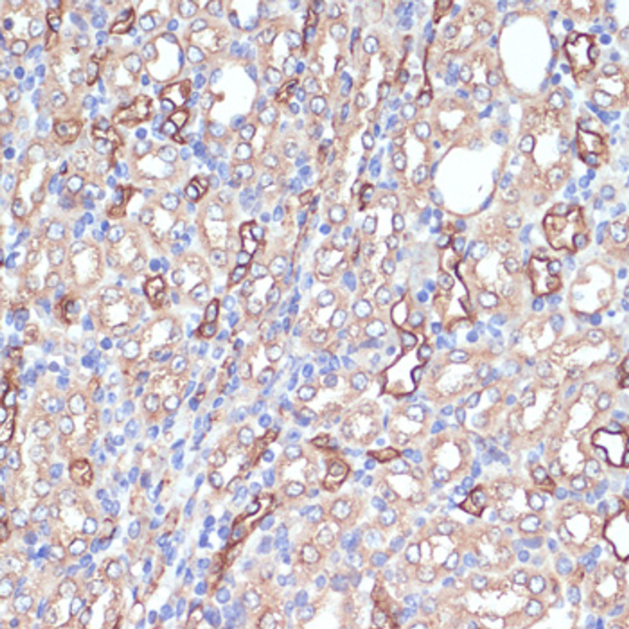 Immunohistochemistry of paraffin-embedded mouse kidney using AQP1 antibody (15-840) at dilution of 1:100 (40x lens) .