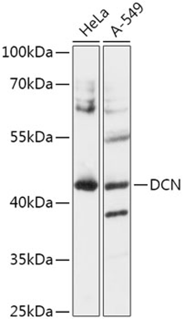 Western blot analysis of extracts of various cell lines, using Decorin antibody (15-848) at 1:1000 dilution.<br/>Secondary antibody: HRP Goat Anti-Rabbit IgG (H+L) at 1:10000 dilution.<br/>Lysates/proteins: 25ug per lane.<br/>Blocking buffer: 3% nonfat dry milk in TBST.<br/>Detection: ECL Basic Kit.<br/>Exposure time: 10s.