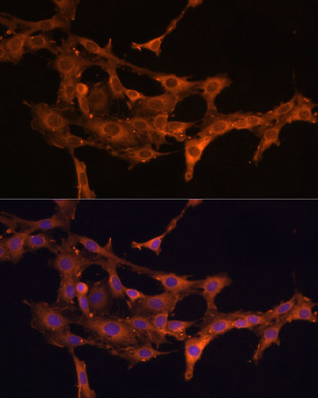 Immunofluorescence analysis of C6 cells using DCN Polyclonal Antibody (15-848) at dilution of 1:100 (40x lens) . Blue: DAPI for nuclear staining.