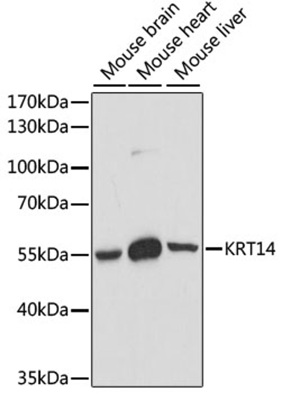 Western blot analysis of extracts of various cell lines, using KRT14 antibody (15-857) at 1:1000 dilution.<br/>Secondary antibody: HRP Goat Anti-Rabbit IgG (H+L) at 1:10000 dilution.<br/>Lysates/proteins: 25ug per lane.<br/>Blocking buffer: 3% nonfat dry milk in TBST.<br/>Detection: ECL Basic Kit.<br/>Exposure time: 90s.