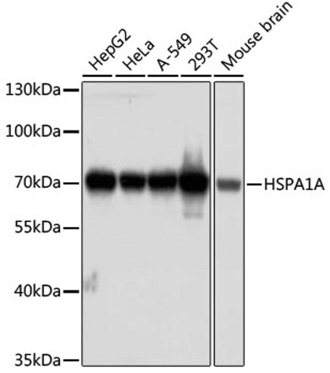 Western blot analysis of extracts of various cell lines, using HSPA1A antibody (15-858) at 1:1000 dilution.<br/>Secondary antibody: HRP Goat Anti-Rabbit IgG (H+L) at 1:10000 dilution.<br/>Lysates/proteins: 25ug per lane.<br/>Blocking buffer: 3% nonfat dry milk in TBST.<br/>Detection: ECL Basic Kit.<br/>Exposure time: 60s.