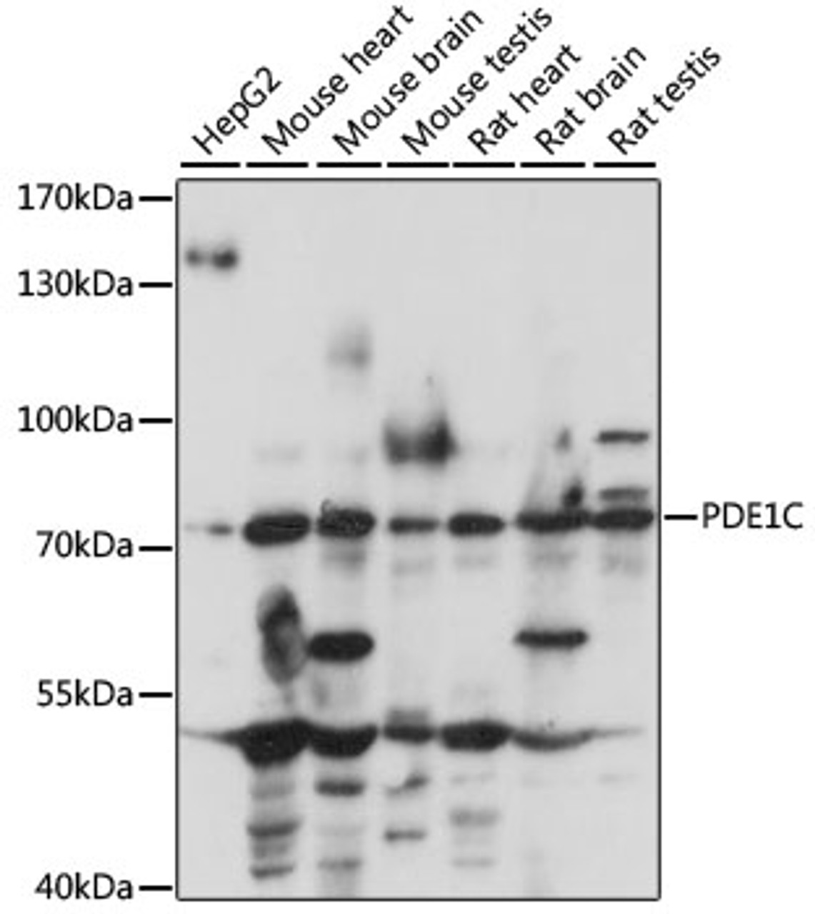 Western blot analysis of extracts of various cell lines, using PDE1C antibody (15-862) at 1:1000 dilution.<br/>Secondary antibody: HRP Goat Anti-Rabbit IgG (H+L) at 1:10000 dilution.<br/>Lysates/proteins: 25ug per lane.<br/>Blocking buffer: 3% nonfat dry milk in TBST.<br/>Detection: ECL Basic Kit.<br/>Exposure time: 10s.