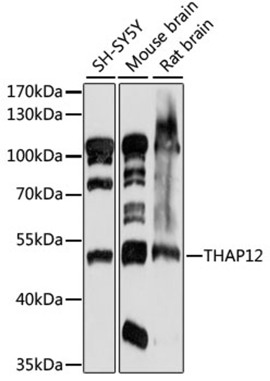 Western blot analysis of extracts of various cell lines, using THAP12 antibody (15-867) at 1:1000 dilution.<br/>Secondary antibody: HRP Goat Anti-Rabbit IgG (H+L) at 1:10000 dilution.<br/>Lysates/proteins: 25ug per lane.<br/>Blocking buffer: 3% nonfat dry milk in TBST.<br/>Detection: ECL Basic Kit.<br/>Exposure time: 30s.