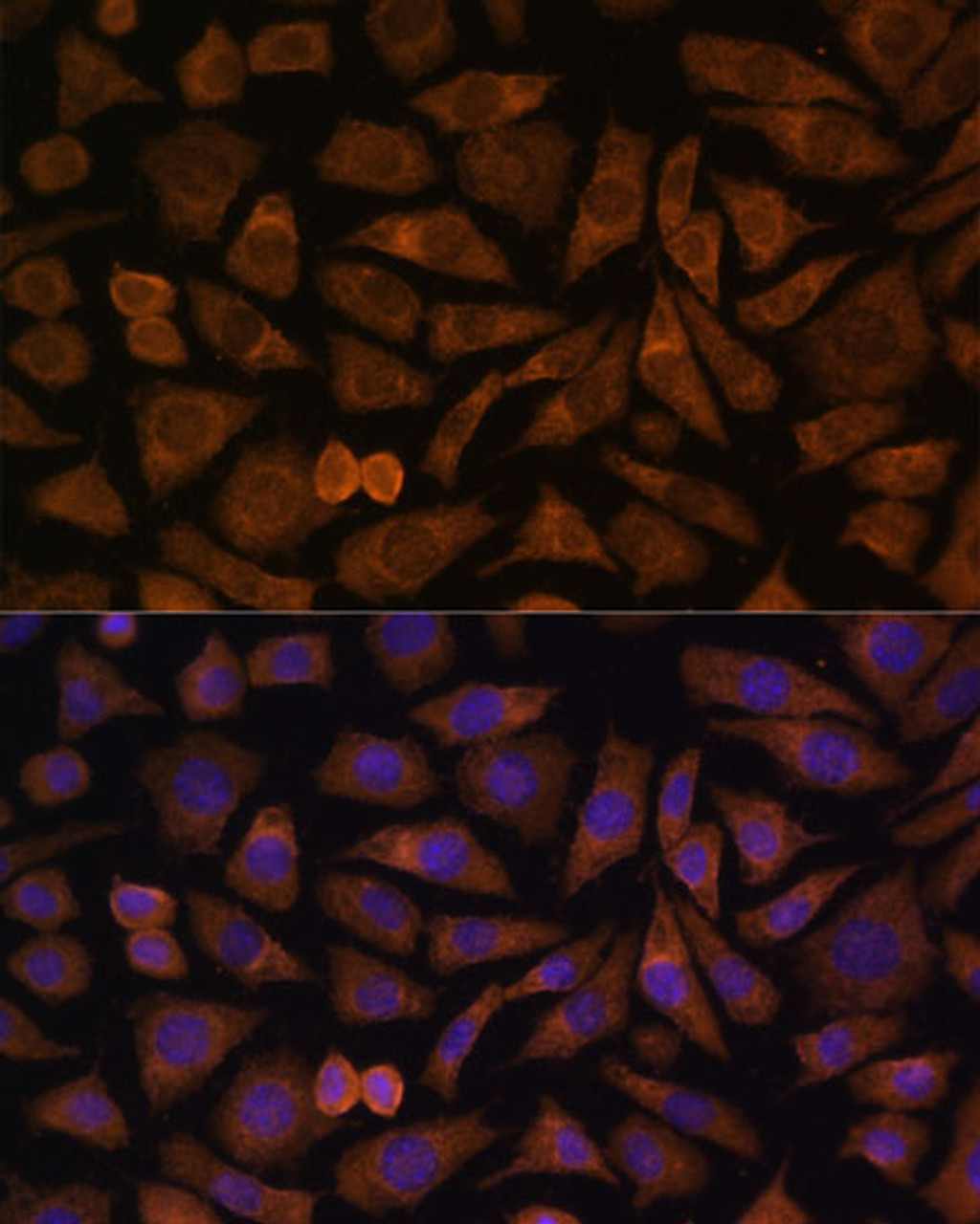 Immunofluorescence analysis of L929 cells using RABIF Polyclonal Antibody (15-871) at dilution of 1:100 (40x lens) . Blue: DAPI for nuclear staining.