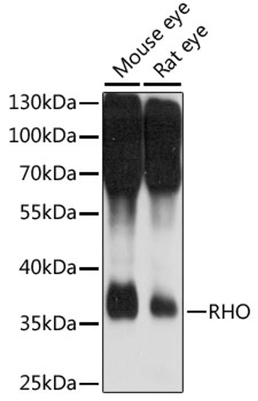 Western blot analysis of extracts of various cell lines, using RHO antibody (15-872) at 1:1000 dilution.<br/>Secondary antibody: HRP Goat Anti-Rabbit IgG (H+L) at 1:10000 dilution.<br/>Lysates/proteins: 25ug per lane.<br/>Blocking buffer: 3% nonfat dry milk in TBST.<br/>Detection: ECL Basic Kit.<br/>Exposure time: 10s.