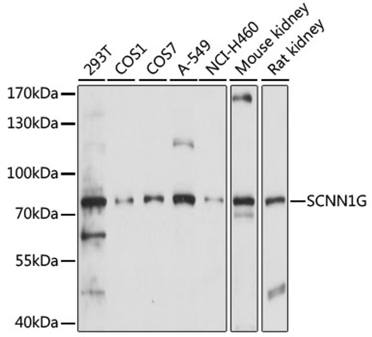 Western blot analysis of extracts of various cell lines, using SCNN1G antibody (15-876) at 1:1000 dilution.<br/>Secondary antibody: HRP Goat Anti-Rabbit IgG (H+L) at 1:10000 dilution.<br/>Lysates/proteins: 25ug per lane.<br/>Blocking buffer: 3% nonfat dry milk in TBST.<br/>Detection: ECL Basic Kit.<br/>Exposure time: 30s.