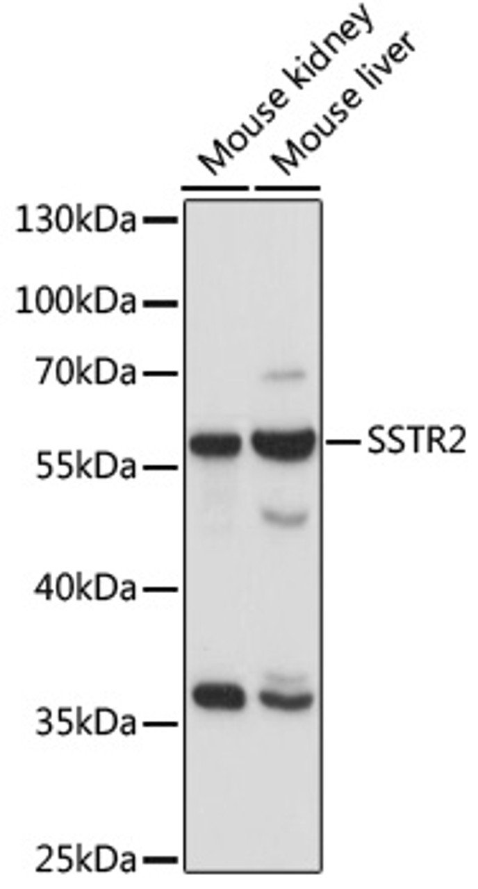 Western blot analysis of extracts of various cell lines, using SSTR2 antibody (15-879) at 1:1000 dilution.<br/>Secondary antibody: HRP Goat Anti-Rabbit IgG (H+L) at 1:10000 dilution.<br/>Lysates/proteins: 25ug per lane.<br/>Blocking buffer: 3% nonfat dry milk in TBST.<br/>Detection: ECL Enhanced Kit.<br/>Exposure time: 30s.